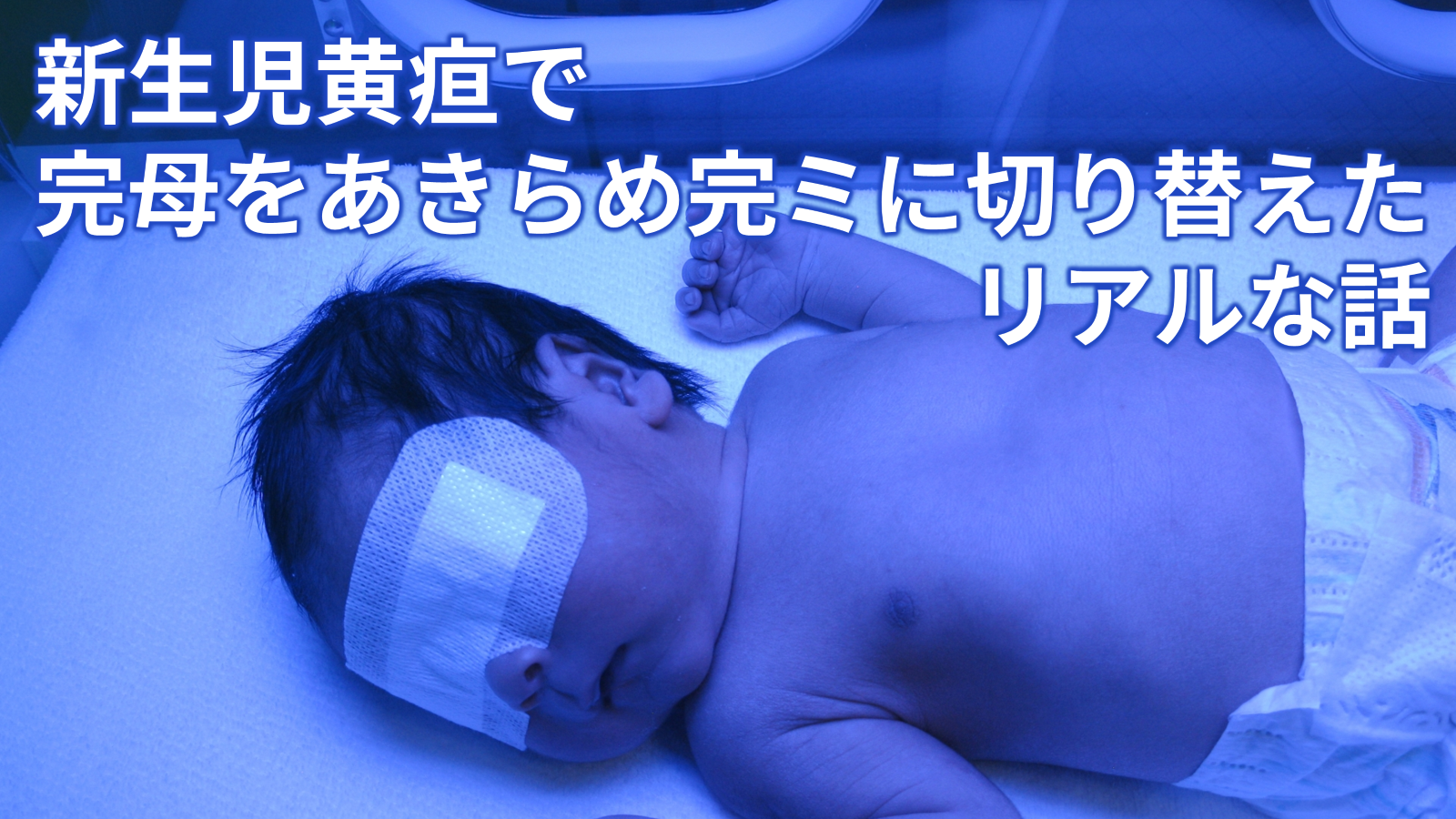 新生児黄疸で完母をあきらめ完ミに切り替えたリアルな話